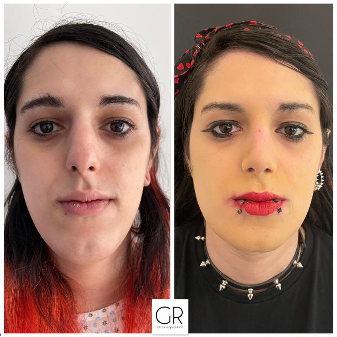 femminilizzazione-2
